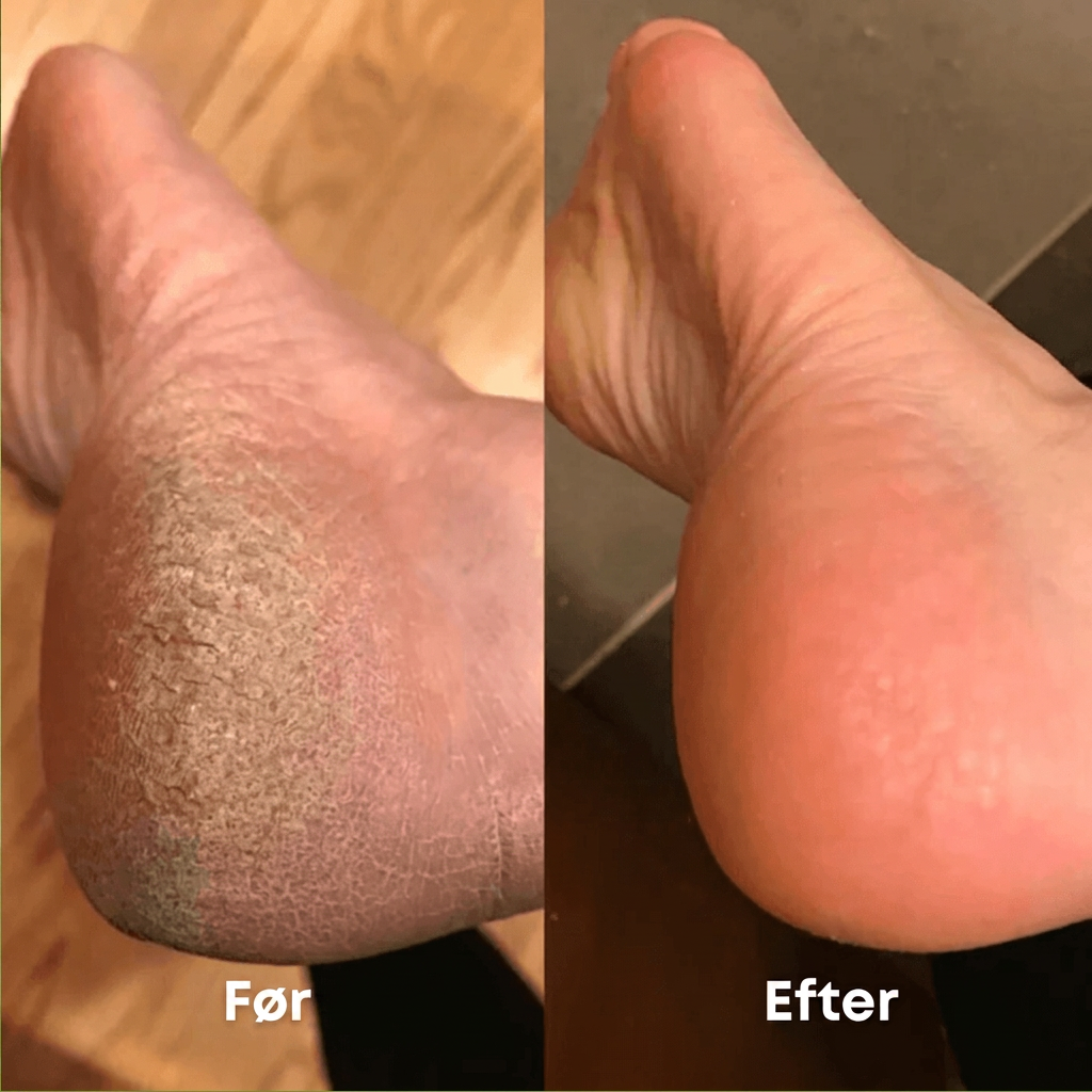 Før og efter